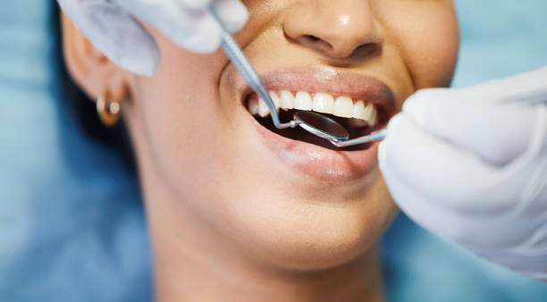 Best Cracked Tooth Emergency Dentist  in Fayette, MS
